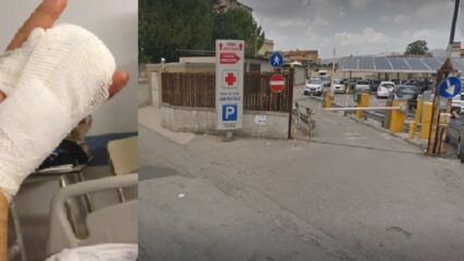Con due dita amputate tenta di truffare l'assicurazione, denunciato dai carabinieri