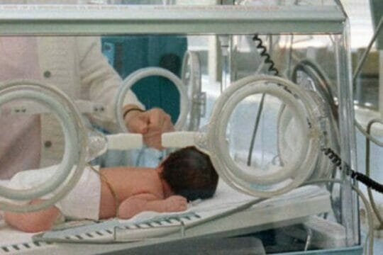 Aveva il cuore spostato a destra, neonato di 28 giorni salvato al Cardarelli di Napoli