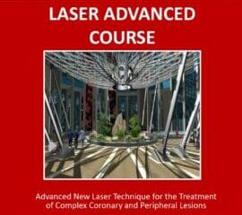 L’Azienda Moscati leader mondiale per l’utilizzo del laser nelle lesioni coronariche