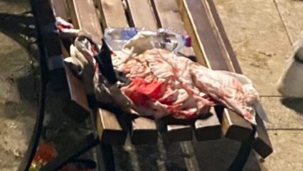 Cervinara: un ragazzo pieno di sangue su una panchina, l'angoscia ed il trauma dei genitori